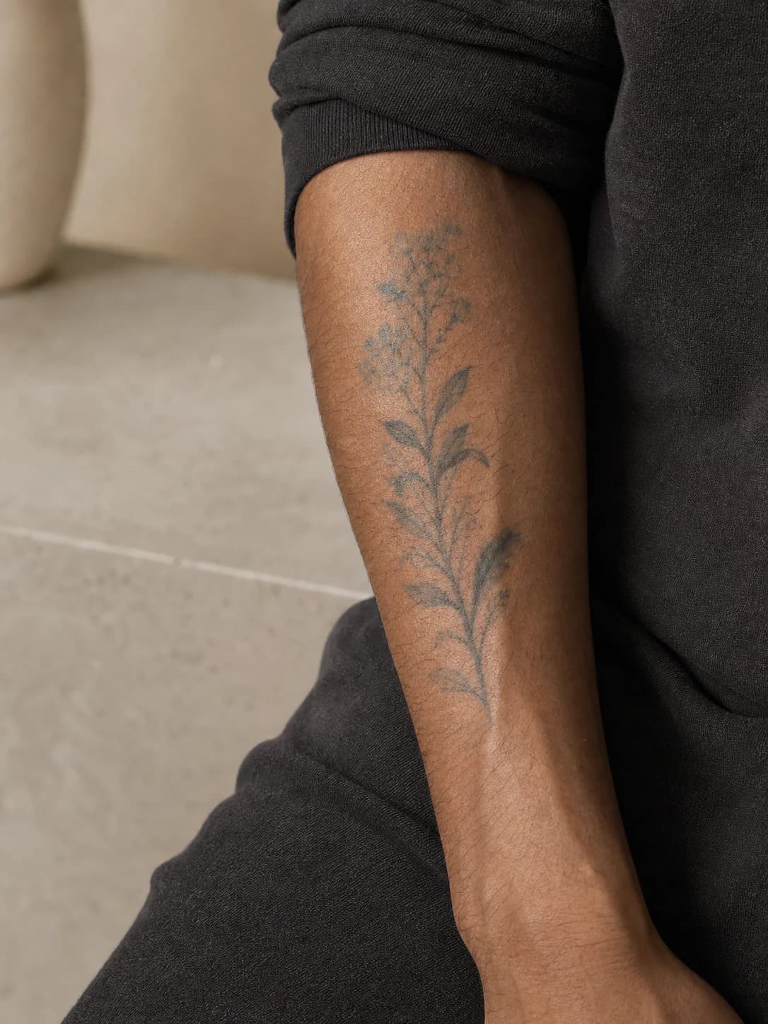 Tattoo Removal