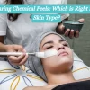 chemical peel ottawa