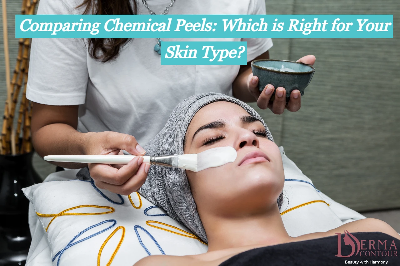 chemical peel ottawa