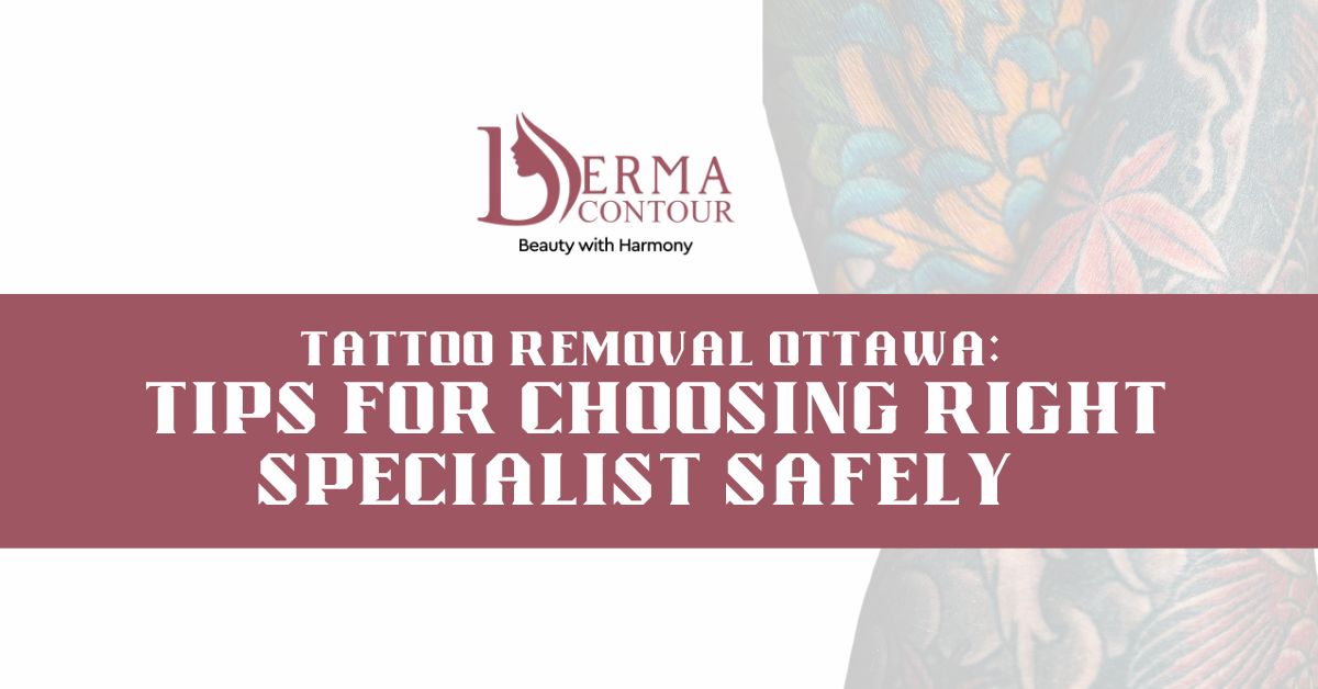 laser tattoo removal ottawa